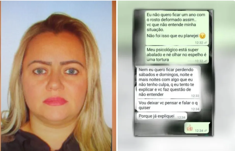 Enfermeira sob Investigação: Pacientes relatam deformações após procedimentos estéticos