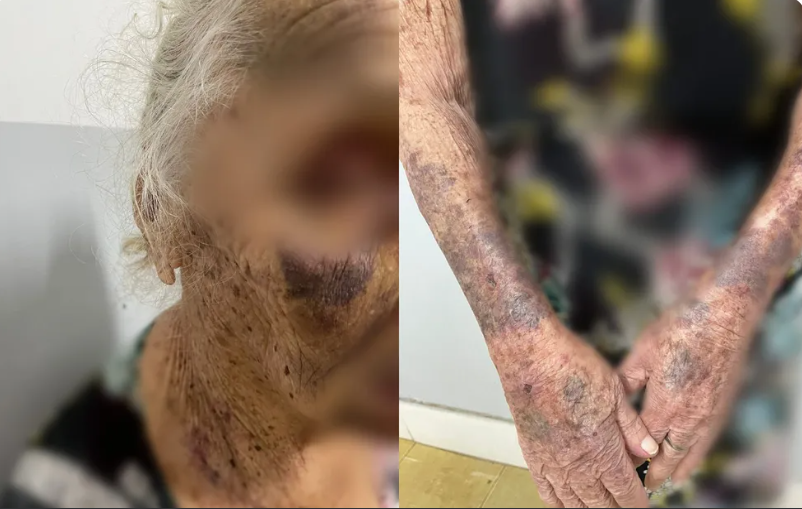 Homem é preso por suspeita de torturar e explorar financeiramente a própria mãe idosa, em Goiânia