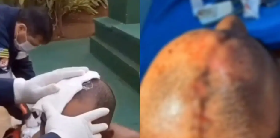 Homem tem corte profundo na cabeça após pular em piscina de Caldas Novas