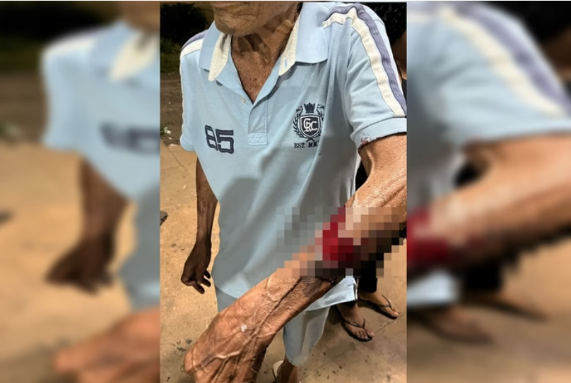 Homem é preso após agredir e arrancar pele do braço do pai em Luziânia