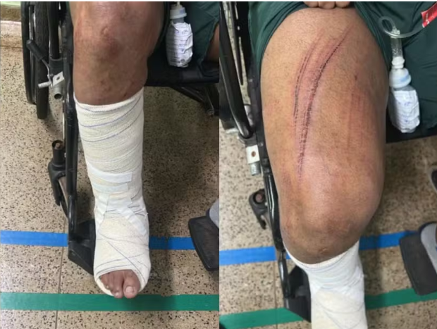 Garoto de programa pula de janela para fugir de clientes que se recusaram a pagar por encontro em Rio Verde